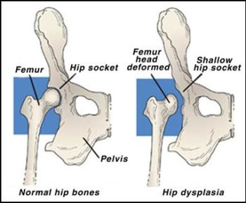 Polly's X-Rays showed she had hip dysplasia