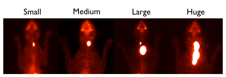 A Thyroid Scan can tell you the size and location of the tumor (picture from hypurrcat website)